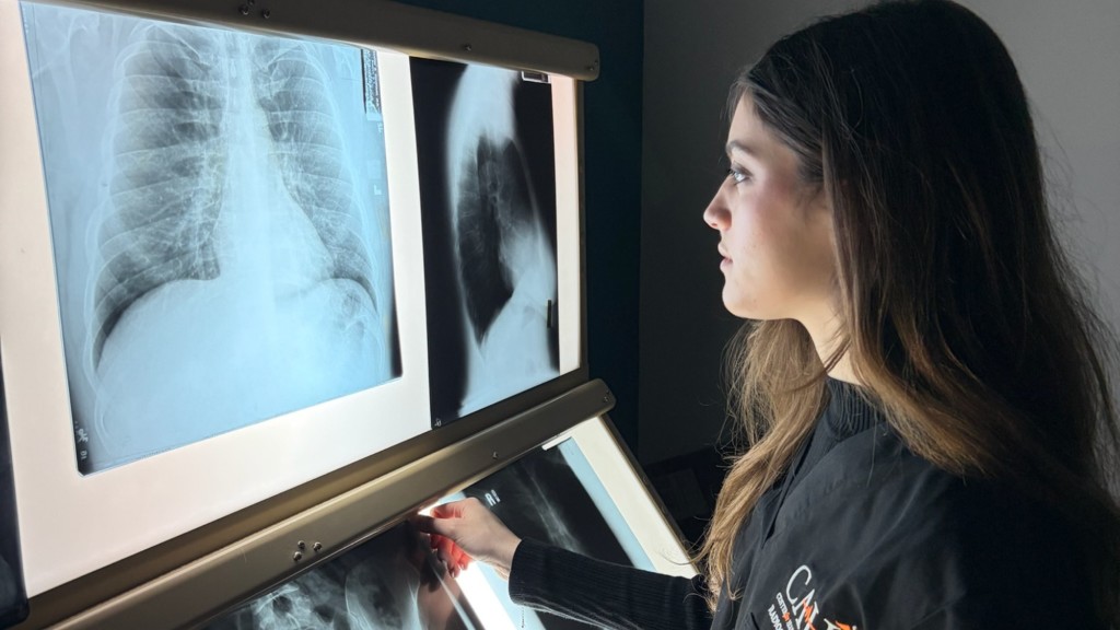 How AI Is Changing Radiology—Without Replacing Healthcare Professionals